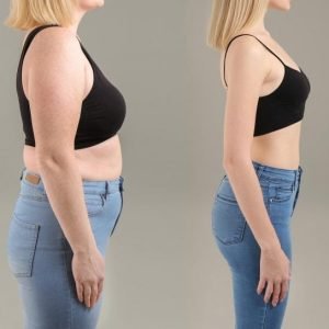 Weight Loss Concept Before and After