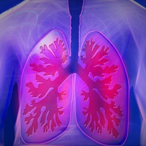 Small cell lung cancer: Facts about the disease