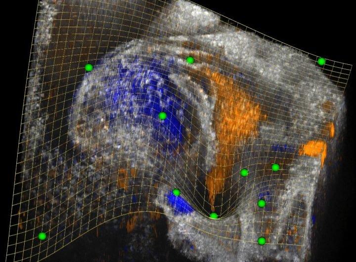 Software tool provides a new view inside complex 3D biomedical images