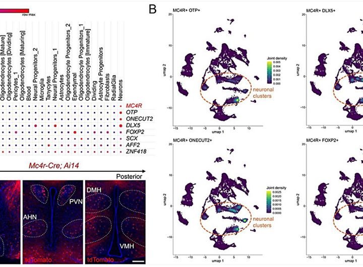 Study implicates another gene in the brain that causes weight gain