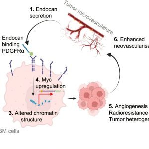 Tumor-secreted protein may hold the key to better treatments for deadly brain tumor