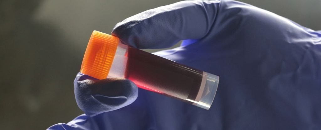 World's First Blood Test For Endometriosis Step Closer Following Trial Success : ScienceAlert